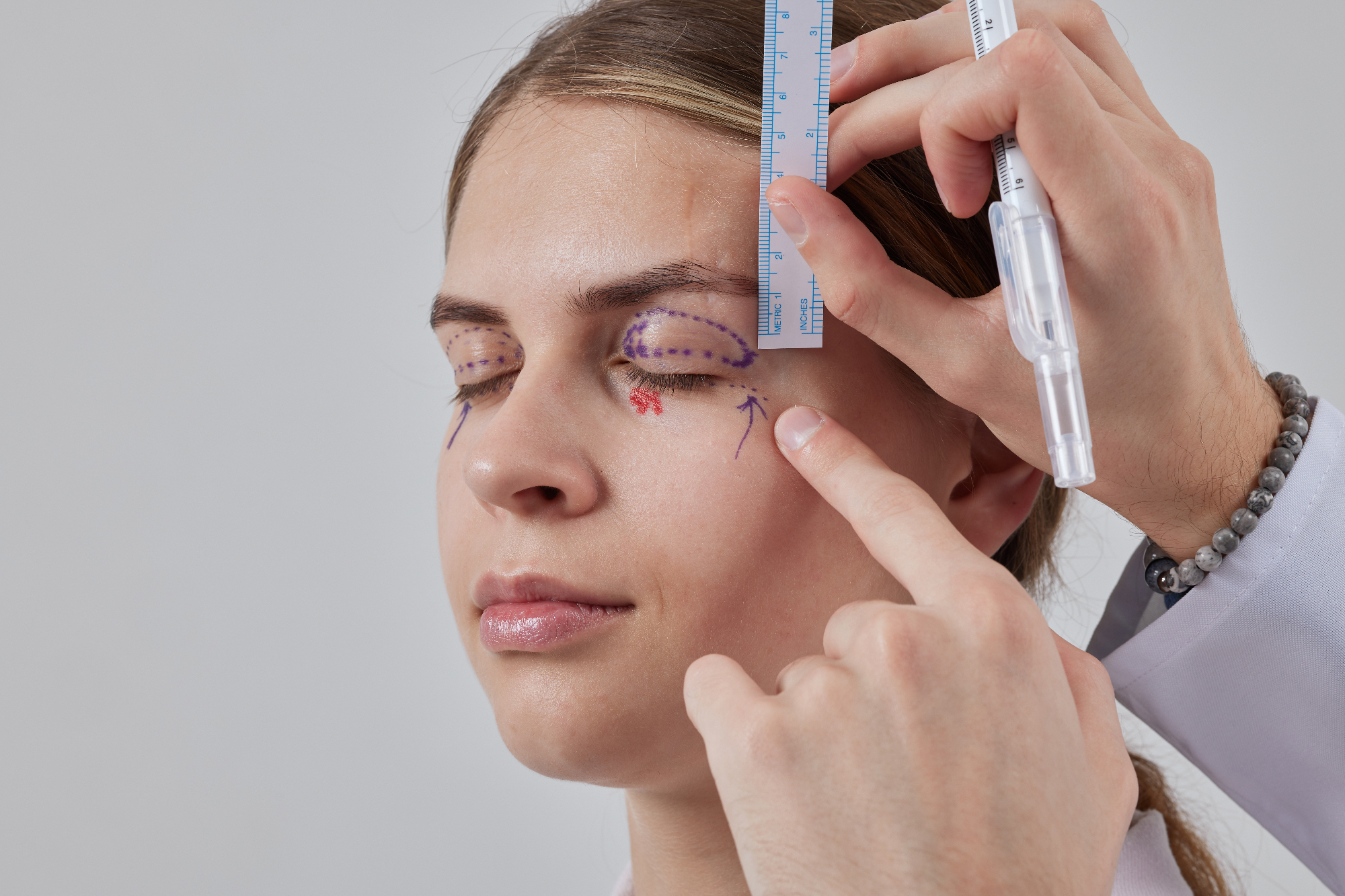 Blefaroplastika je babici spremenila življenje na bolje